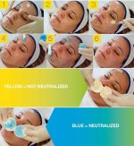 Easy Droxy Azelaic Peel – Ķīmiskais pīlings